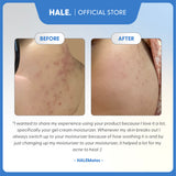 HALE All Rounder Gel Cream Moisturizer