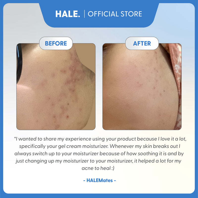 HALE All Rounder Gel Cream Moisturizer