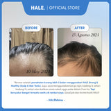 HALE Strong & Healthy | Scalp & Hair Tonic