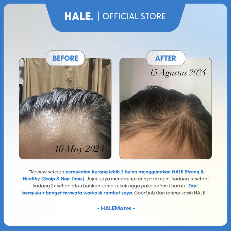HALE Strong & Healthy | Scalp & Hair Tonic